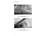 Free Your Fascia view 10